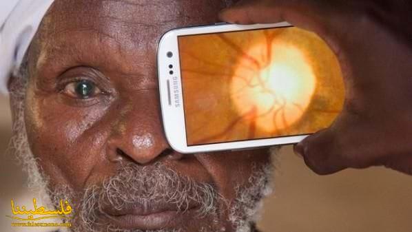 تطبيق ذكي جديد يبشر بتسهيل إجراء فحوصات العين في جميع أنحاء العالم