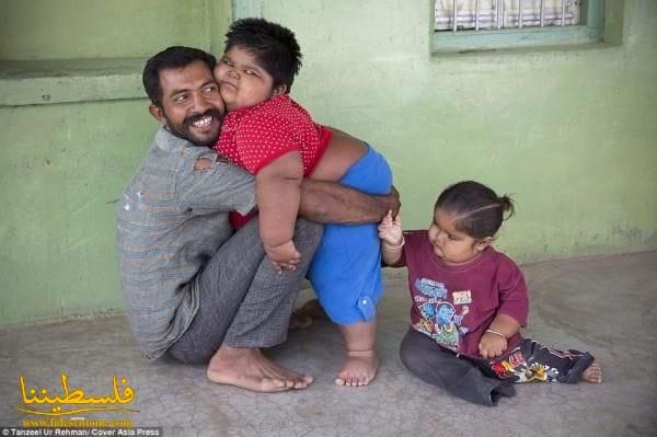 أب هندي يبيع كليته لتغطية مصاريف أطفاله الأسمن في العالم
