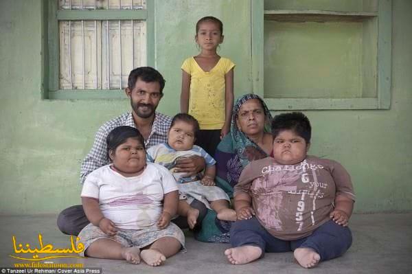 أب هندي يبيع كليته لتغطية مصاريف أطفاله الأسمن في العالم