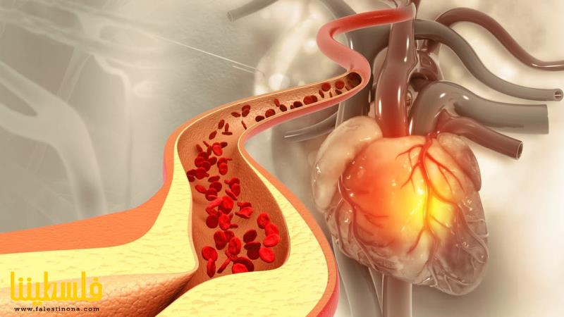 الكوليسترول "الجيد" ليس جيداً