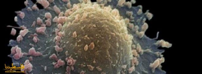 باحثون أمريكيون: يعلنون التوصل ل"علاج ثوري" يدمّر السرطان ب10 ...