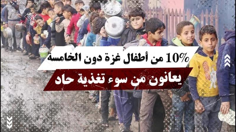 الأمم المتحدة: 10% من أطفال غزة دون الخامسة يعانون من سوء تغذية حاد