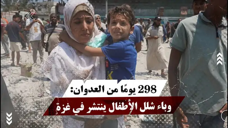 298 يومًا من العدوان: وباء شلل الأطفال ينتشر...